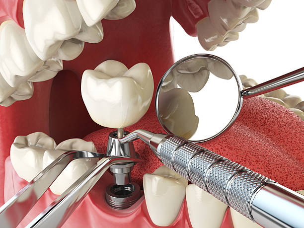Best Emergency Tooth Extraction in Midway City, CA
