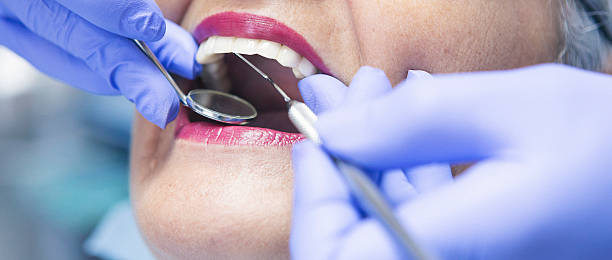 Best Emergency Treatment for Dental Infections or Abscesses in Midway City, CA